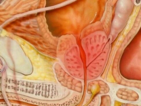 A type of healthy prostate of a person