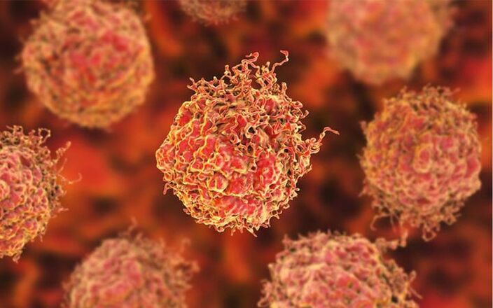 Prostate cancer stations